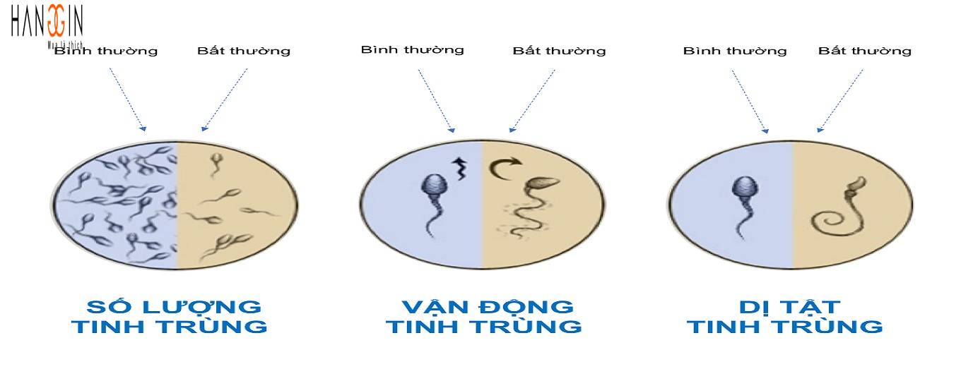 tinh trùng dị dạng