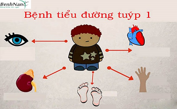 bệnh tiểu đường tuýp 1 có nguy hiểm không