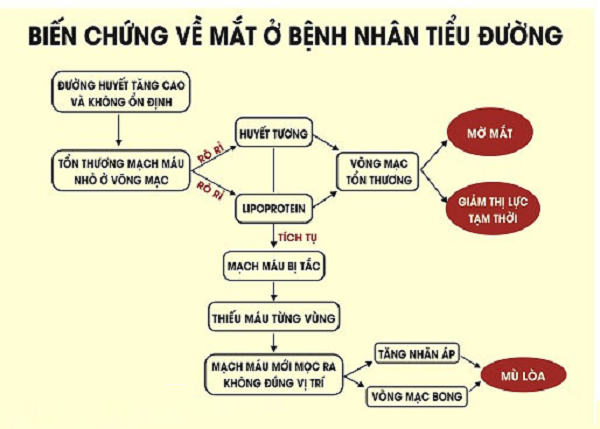 Mờ mắt do biến chứng tiểu đường